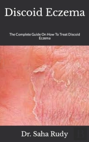 Discoid Eczema