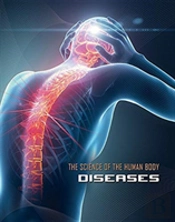 Diseases