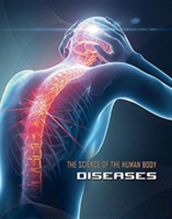 Bertrand.pt - Diseases