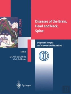 Bertrand.pt - Diseases Of The Brain, Head And Neck, Spine