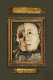 Diseases Of The Teeth