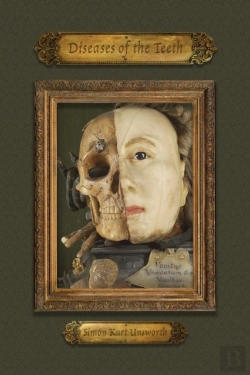 Bertrand.pt - Diseases Of The Teeth