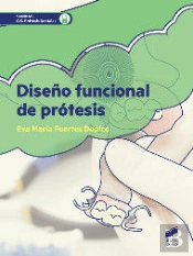 Diseño Funcional De Prótesis