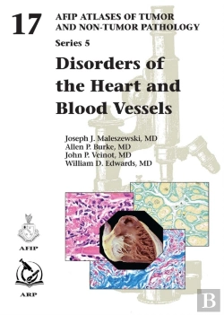 Bertrand.pt - Disorders Of The Heart And Blood Vessels
