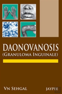 Bertrand.pt - Donovanosis (Granuloma Inguinale)