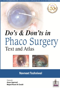 Bertrand.pt - Do'S & Dont'S In Phaco Surgery