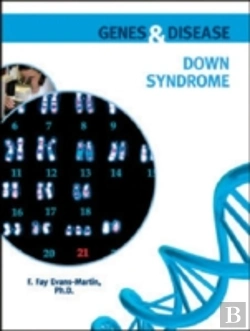Bertrand.pt - Down Syndrome