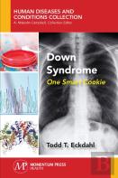 Down Syndrome