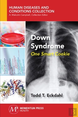 Bertrand.pt - Down Syndrome