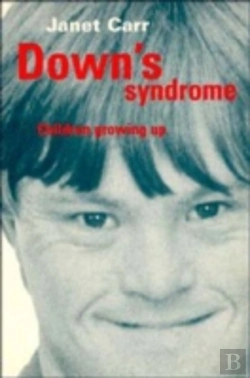 Bertrand.pt - Down'S Syndrome