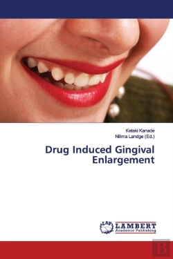 Bertrand.pt - Drug Induced Gingival Enlargement