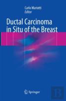 Ductal Carcinoma In Situ Of The Breast