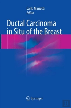 Bertrand.pt - Ductal Carcinoma In Situ Of The Breast
