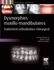 Dysmorphies Maxillo-Mandibulaires ; Traitement Orthodontico-Chirurgical