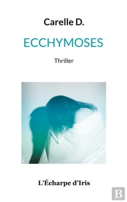 Bertrand.pt - Ecchymoses