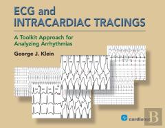 Ecg And Intracardiac Tracings