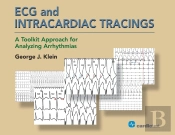 Ecg And Intracardiac Tracings