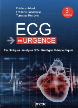Bertrand.pt - Ecg En Urgence
