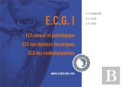 Ecg I : Ecg Normal Et Pathologique, Ecg Des Douleurs Thoraciques, Ecg Des Cardiomyopathies