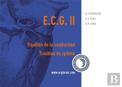 Bertrand.pt - Ecg Ii : Troubles De La Conduction, Troubles Du Rythme