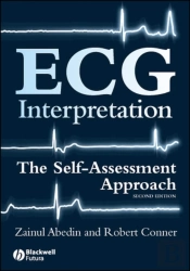 Ecg Interpretation