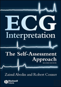 Bertrand.pt - Ecg Interpretation