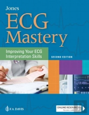 Ecg Mastery