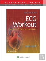 Ecg Workout
