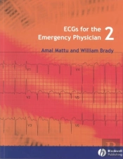 Ecgs For The Emergency Physician 2