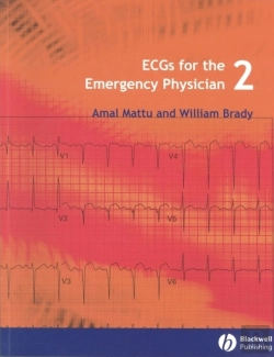 Bertrand.pt - Ecgs For The Emergency Physician 2