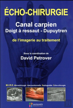 Bertrand.pt - Echo-Chirurgie Canal Carpien, Doigt A Ressaut Et Dupuytren