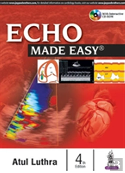 Bertrand.pt - Echo Made Easy