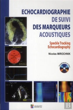 Bertrand.pt - Échocardiographie De Suivi Des Marqueurs Acoustiques ; Speckle Tracking Echocardiography