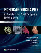 Echocardiography In Pediatric And Adult Congenital Heart Disease