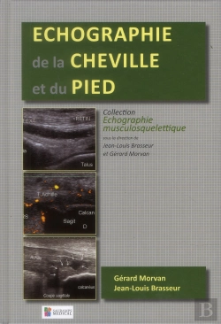 Bertrand.pt - Échographie De La Cheville Et Du Pied
