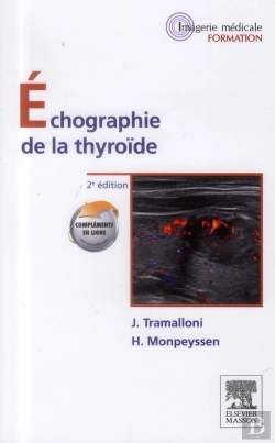 Bertrand.pt - Échographie De La Thryroïde
