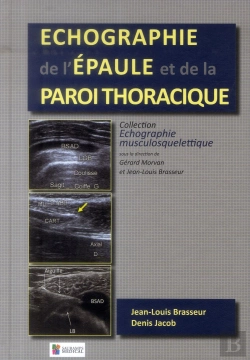 Bertrand.pt - Echographie De L'Epaule Et De La Paroi Thoracique