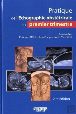 Bertrand.pt - Échographie Obstétricale 1er Trimestre (2e Édition)