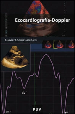 Bertrand.pt - Ecocardiografía-Doppler