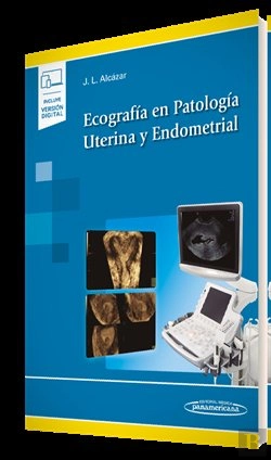 Bertrand.pt - Ecografía En Patología Uterina Y Endometrial