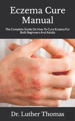 Bertrand.pt - Eczema Cure Manual