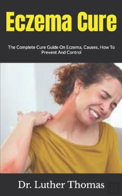 Bertrand.pt - Eczema Cure