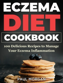 Bertrand.pt - Eczema Diet Cookbook: 100 Delicious Reci