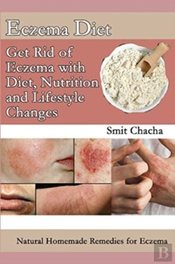 Bertrand.pt - Eczema Diet - Get Rid Of Eczema With Diet, Nutrition And Lifestyle Changes