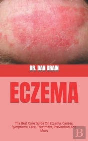 Eczema