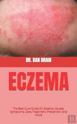 Bertrand.pt - Eczema