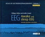 Eeg - Awake And Sleep Eeg