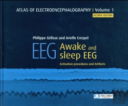 Bertrand.pt - Eeg - Awake And Sleep Eeg