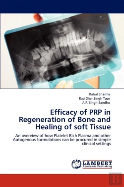 Bertrand.pt - Efficacy Of Prp In Regeneration Of Bone And Healing Of Soft Tissue
