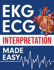Ekg | Ecg Interpretation Made Easy